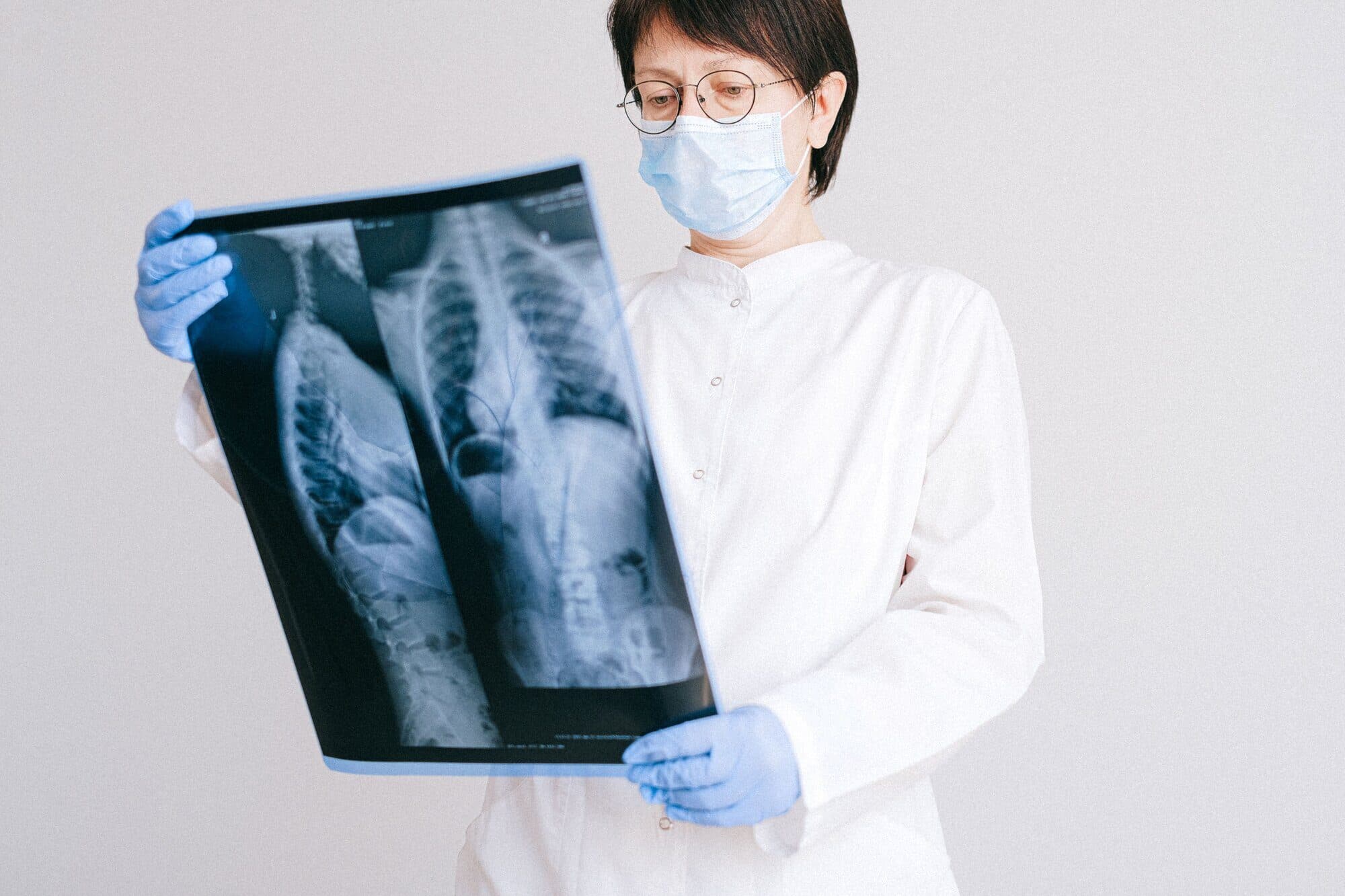 Clinician reviewing a spinal X-ray